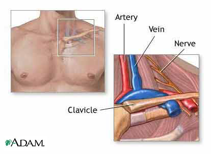Thoracic Outlet